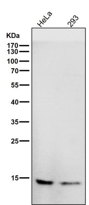 Anti-CDKN2A/p14ARF Rabbit Monoclonal Antibody Boster Bio