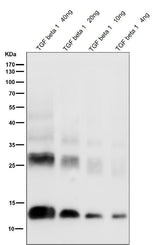 Anti-TGF beta 1 Rabbit Monoclonal Antibody Boster Bio