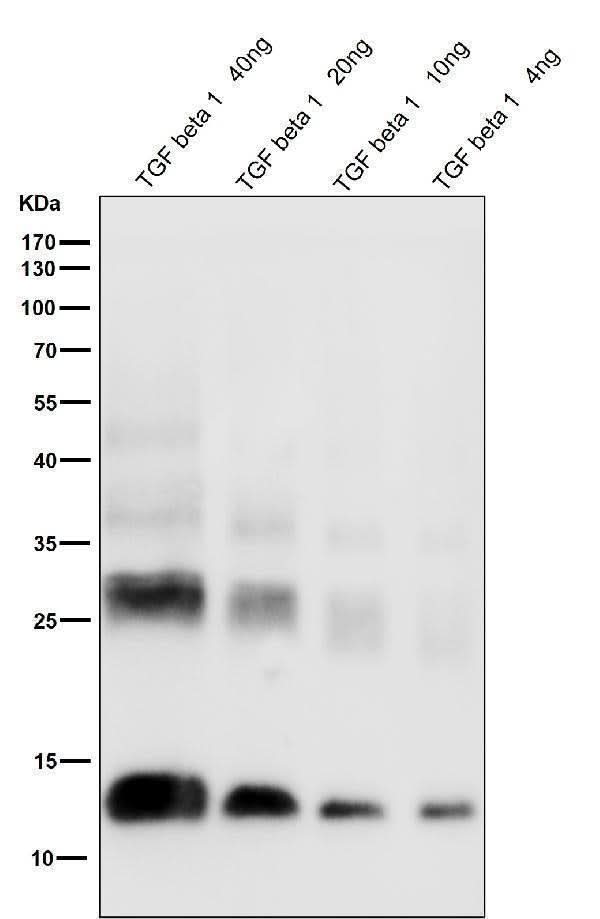 Anti-TGF beta 1 Rabbit Monoclonal Antibody Boster Bio