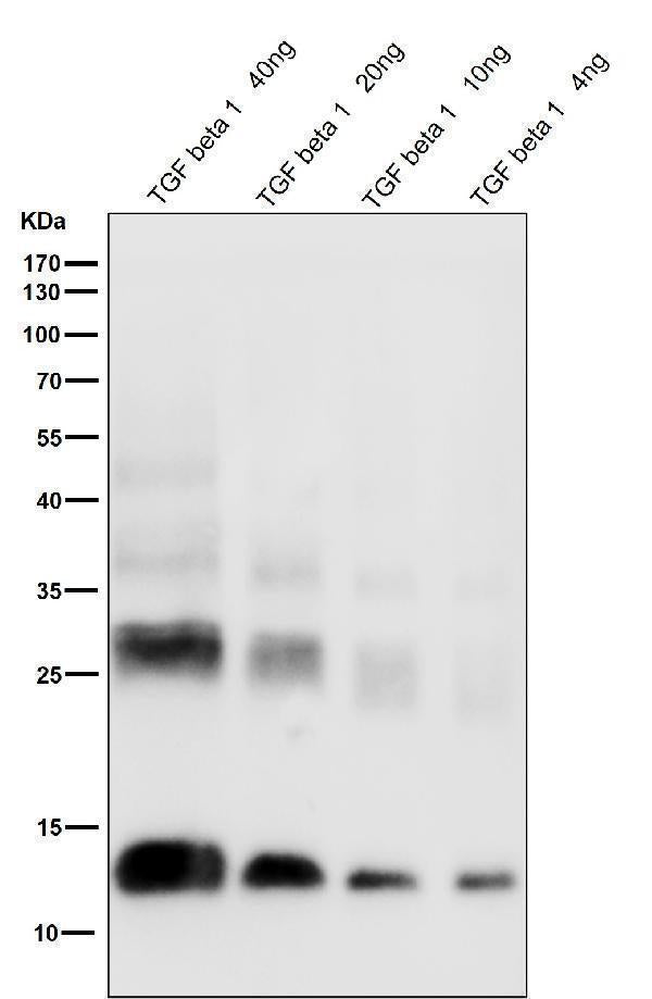 Anti-TGF beta 1 Rabbit Monoclonal Antibody Boster Bio