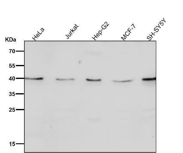 Anti-CTLA4 (CD152) Monoclonal Antibody Boster Bio