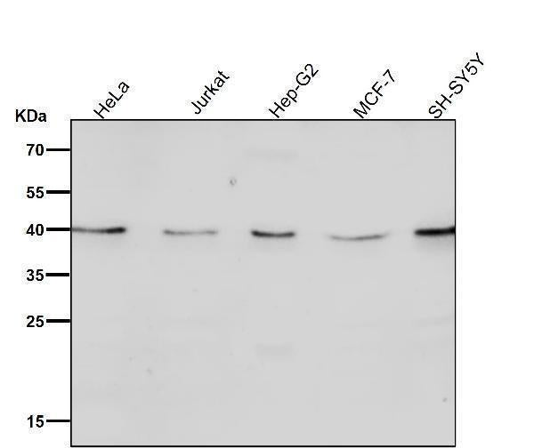 Anti-CTLA4 (CD152) Monoclonal Antibody Boster Bio