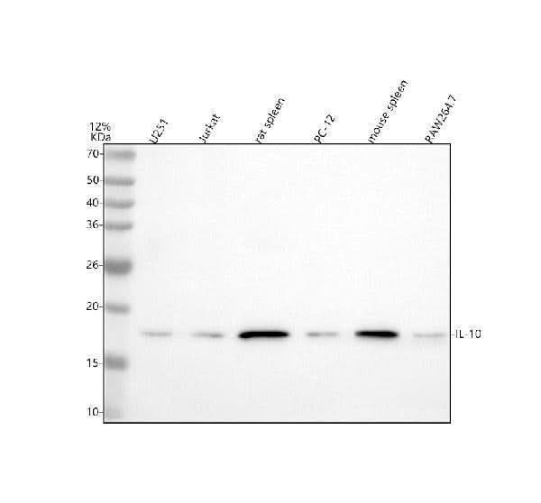 Anti-IL10 Monoclonal Antibody Boster Bio