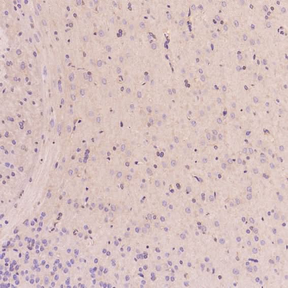 Anti-EGFR (ErbB 1) Monoclonal Antibody Boster Bio