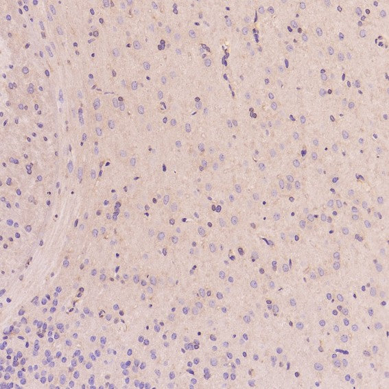 Anti-EGFR (ErbB 1) Monoclonal Antibody Boster Bio