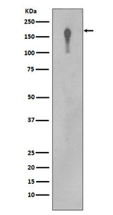 Anti-EGFR Rabbit Monoclonal Antibody Boster Bio