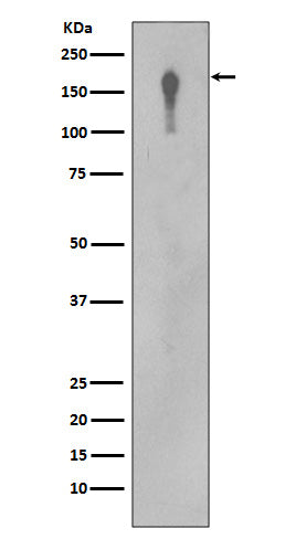 Anti-EGFR Rabbit Monoclonal Antibody Boster Bio