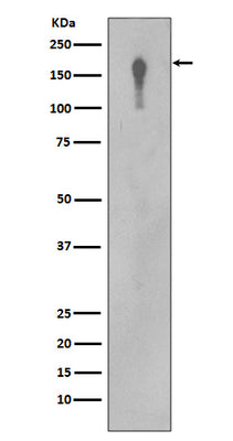 Anti-EGFR Rabbit Monoclonal Antibody Boster Bio