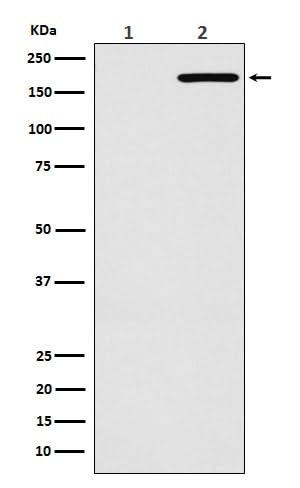 Anti-EGFR(L858R mutation) Rabbit Monoclonal Antibody Boster Bio