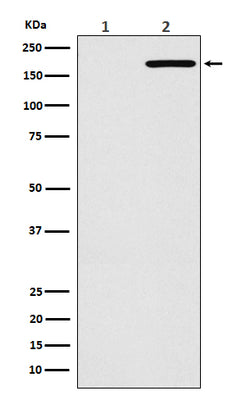 Anti-EGFR(L858R mutation) Rabbit Monoclonal Antibody Boster Bio