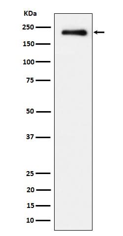 Anti-Phospho-EGFR (Y845) Rabbit Monoclonal Antibody Boster Bio