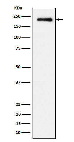 Anti-Phospho-EGFR (Y845) Rabbit Monoclonal Antibody Boster Bio