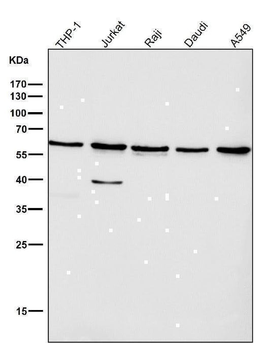 Anti-Akt(pan) 1/2/3 Rabbit Monoclonal Antibody Boster Bio