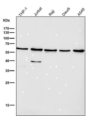 Anti-Akt(pan) 1/2/3 Rabbit Monoclonal Antibody Boster Bio
