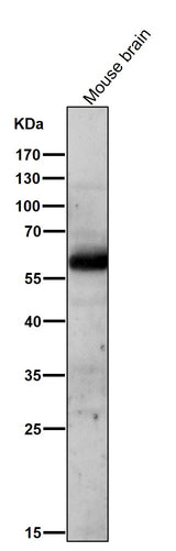 Anti-AKT1/2 Rabbit Monoclonal Antibody Boster Bio