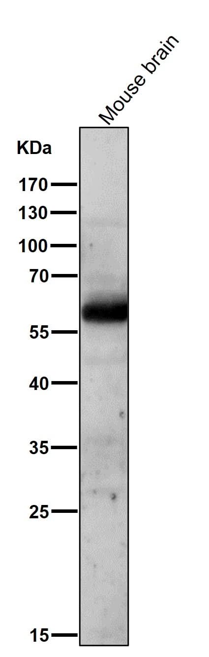 Anti-AKT1/2 Rabbit Monoclonal Antibody Boster Bio
