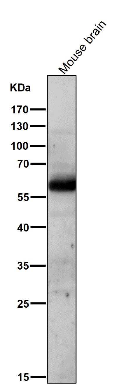 Anti-AKT1/2 Rabbit Monoclonal Antibody Boster Bio