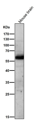 Anti-AKT1/2 Rabbit Monoclonal Antibody Boster Bio