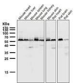 Anti-AKT1 + AKT2 + AKT3 Rabbit Monoclonal Antibody Boster Bio