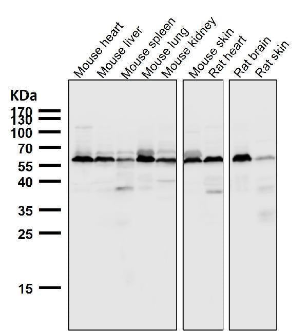 Anti-AKT1 + AKT2 + AKT3 Rabbit Monoclonal Antibody Boster Bio