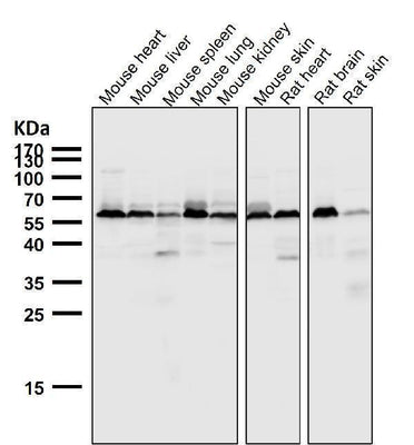 Anti-AKT1 + AKT2 + AKT3 Rabbit Monoclonal Antibody Boster Bio