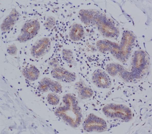 Anti-MyD88 Monoclonal Antibody Boster Bio