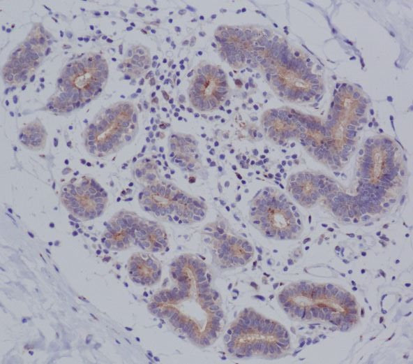 Anti-MyD88 Monoclonal Antibody Boster Bio