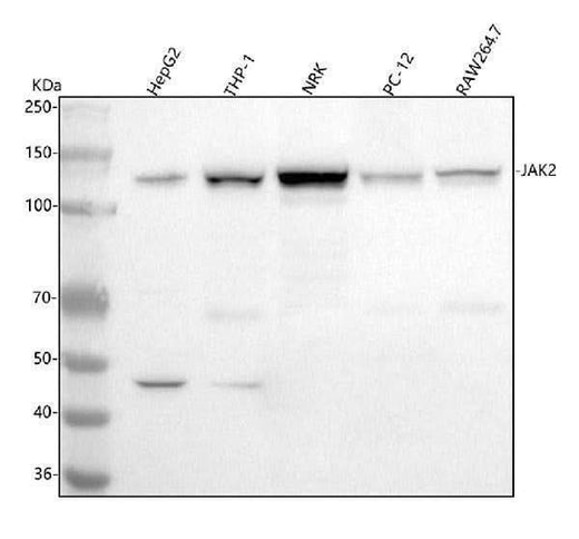 Anti-JAK2 Monoclonal Antibody Boster Bio