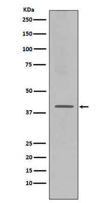 Anti-CXCR4 Monoclonal Antibody Boster Bio