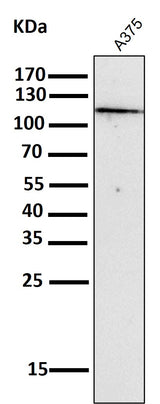 Anti-NALP3 NLRP3 Rabbit Monoclonal Antibody Boster Bio