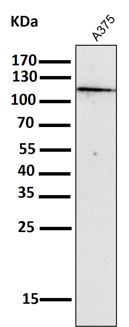 Anti-NALP3 NLRP3 Rabbit Monoclonal Antibody Boster Bio