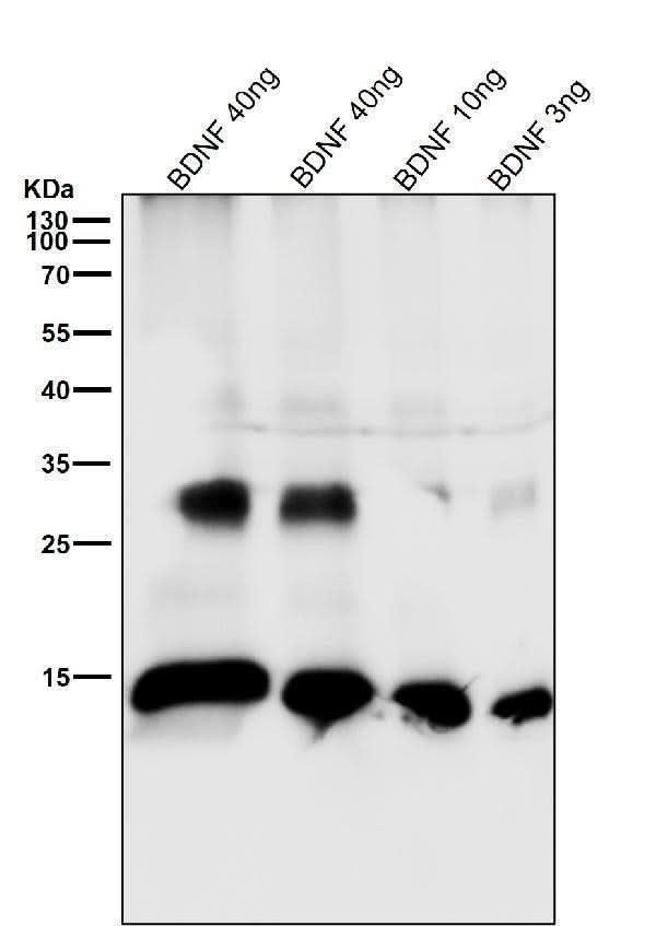 Anti-BDNF Rabbit Monoclonal Antibody Boster Bio