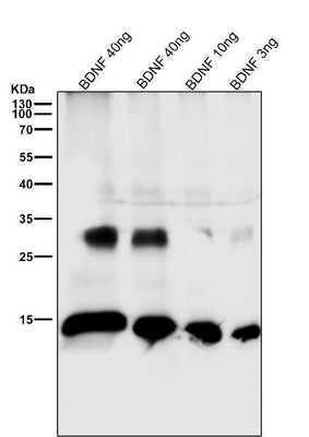 Anti-BDNF Rabbit Monoclonal Antibody Boster Bio