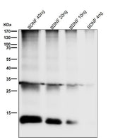 Anti-BDNF Rabbit Monoclonal Antibody Boster Bio
