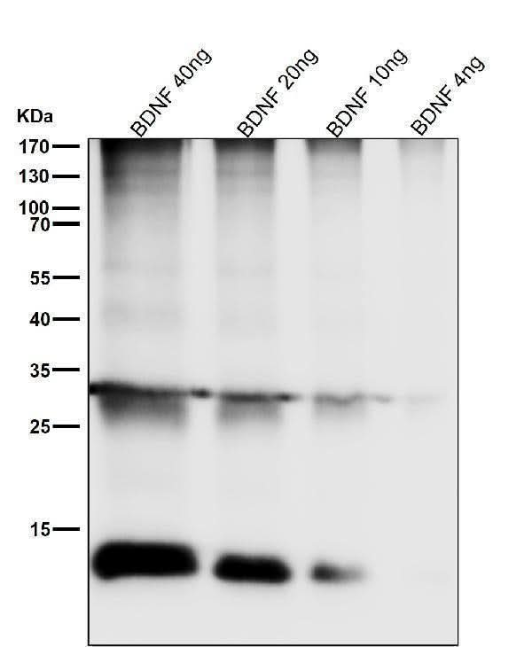 Anti-BDNF Rabbit Monoclonal Antibody Boster Bio
