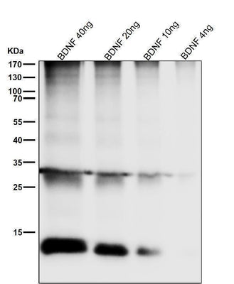 Anti-BDNF Rabbit Monoclonal Antibody Boster Bio