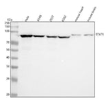 Anti-STAT1 Rabbit Monoclonal Antibody Boster Bio