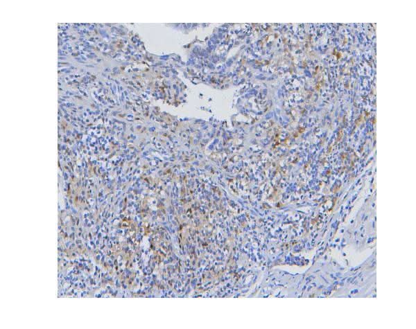 Anti-STAT1 Antibody Picoband® (monoclonal, 12C7 Boster Bio
