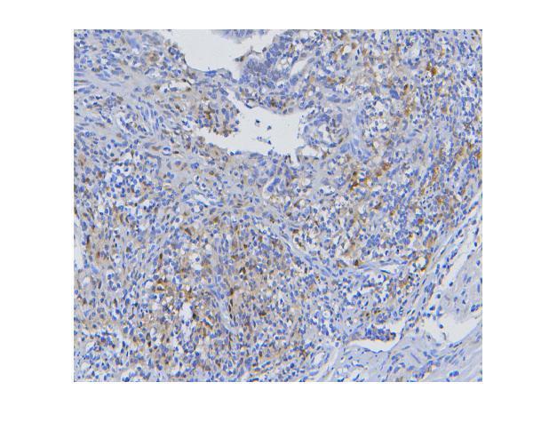 Anti-STAT1 Antibody Picoband® (monoclonal, 12C7 Boster Bio