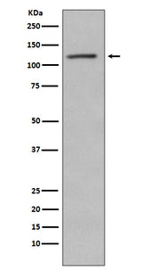 Anti-Phospho-Retinoblastoma (S780) RB1 Rabbit Monoclonal Antibody Boster Bio