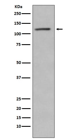 Anti-Phospho-Retinoblastoma (S780) RB1 Rabbit Monoclonal Antibody Boster Bio