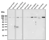 Anti-Rb RB1 Rabbit Monoclonal Antibody Boster Bio