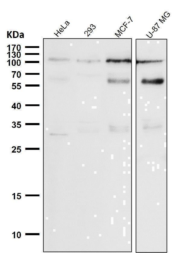 Anti-Phospho-Rb (S780) Rabbit Monoclonal Antibody Boster Bio