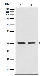 Anti-Bcl-2 Rabbit Monoclonal Antibody Boster Bio