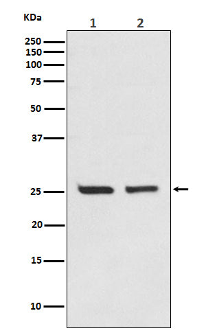 Anti-Bcl-2 Rabbit Monoclonal Antibody Boster Bio