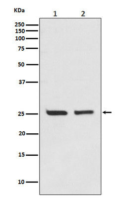 Anti-Bcl-2 Rabbit Monoclonal Antibody Boster Bio