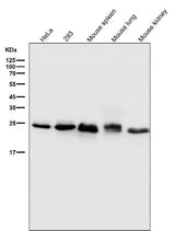 Anti-Bcl-2 Rabbit Monoclonal Antibody Boster Bio