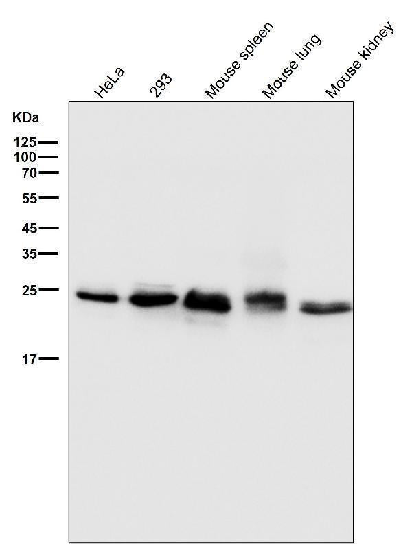 Anti-Bcl-2 Rabbit Monoclonal Antibody Boster Bio