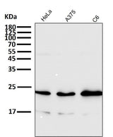 Anti-Rac1/2/3 Rabbit Monoclonal Antibody Boster Bio