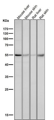 Anti-Caspase-8 CASP8 Rabbit Monoclonal Antibody Boster Bio